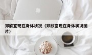 郑欣宜现在身体状况（郑欣宜现在身体状况图片）