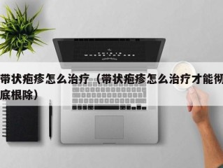 带状疱疹怎么治疗（带状疱疹怎么治疗才能彻底根除）