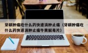 牙龈肿痛吃什么药快速消肿止痛（牙龈肿痛吃什么药快速消肿止痛牛黄解毒片）