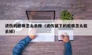 烫伤的疤痕怎么去除（烫伤留下的疤痕怎么能去掉）