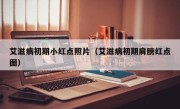 艾滋病初期小红点照片（艾滋病初期肩膀红点图）