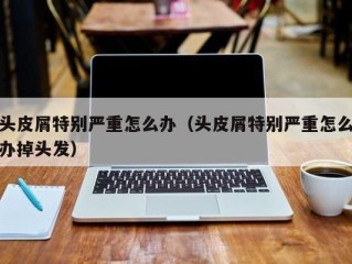 头皮屑特别严重怎么办（头皮屑特别严重怎么办掉头发）