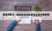 脂溢性皮炎（脂溢性皮炎脸部怎么治才能断根）