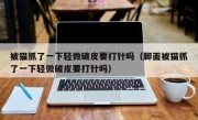 被猫抓了一下轻微破皮要打针吗（脚面被猫抓了一下轻微破皮要打针吗）